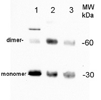 PIP2-1-7 | Plasma membrane aquaporin isoforms 1-7, C-terminal in the group Antibodies Plant/Algal / Membrane Transport System / Plasma membrane at Agrisera AB (Antibodies for research) (AS12 2110)